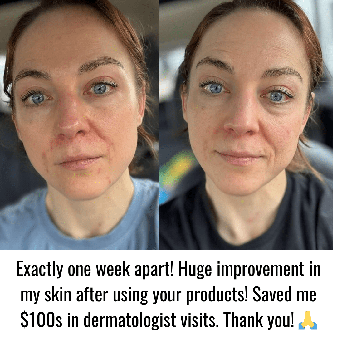 Total Cranarchy Multi-Use Balm