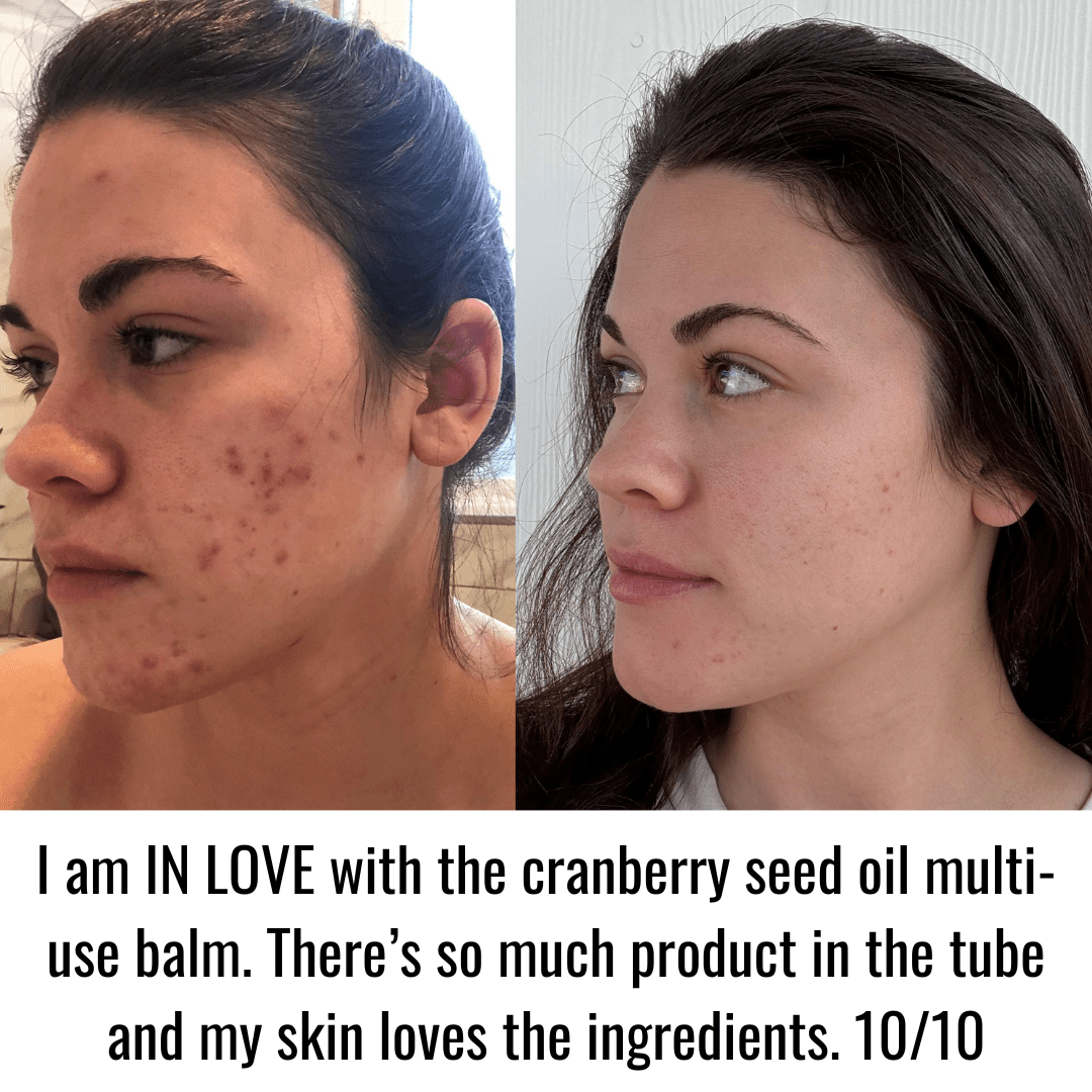 Total Cranarchy Multi-Use Balm