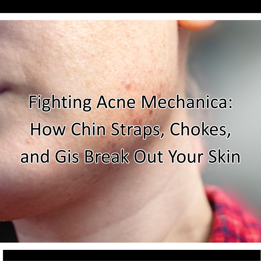 Fighting Acne Mechanica: How Chin Straps, Chokes, and Gis Break Out Your Skin
