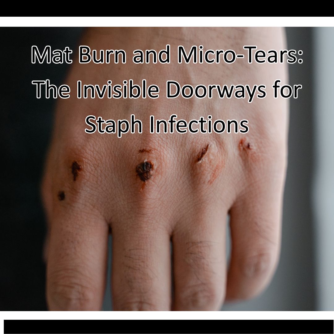 Mat Burn and Micro-Tears: The Invisible Doorways for Staph Infections