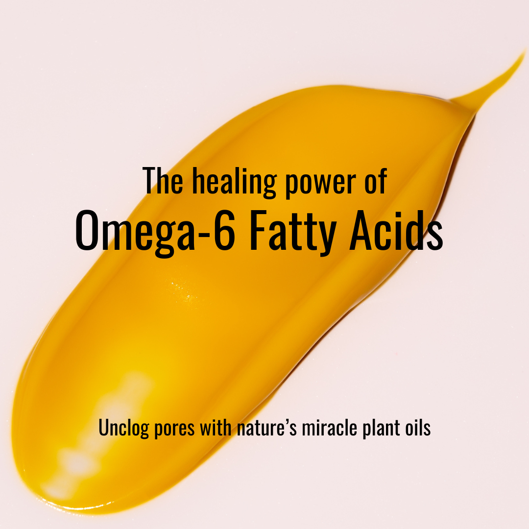 Omega-6 for "Sweat Acne"